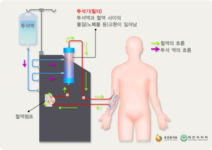 혈액투석 보식도