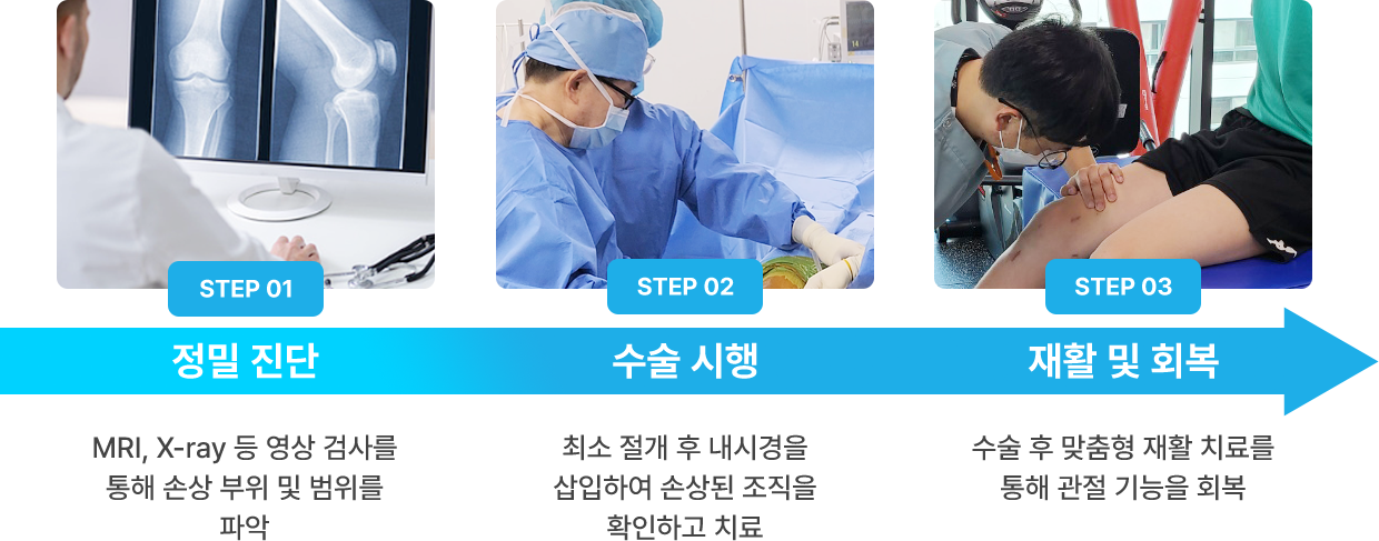 관절내시경 수술과정안내: 정밀 진단, 수술 시행, 재활 및 회복