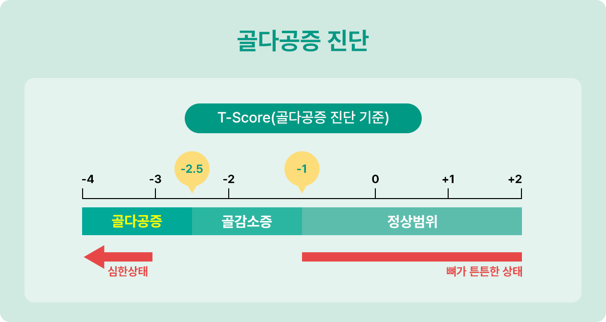 골다공증 진단 기준 T-Score 그래프: -1 이상 정상, -1 미만에서 -2.5 초과 골감소증, -2.5 이하 골다공증